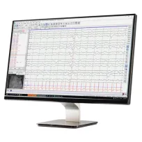 NeuroWorks EEG ծրագիր