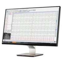 Natus®NeuroWorks® EEG ծրագիր