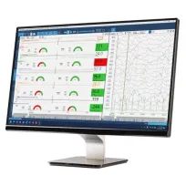 Moberg CNS Envision ծրագիր